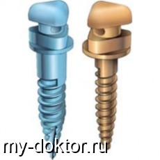Микроимпланты VectorTAS в ортодонтии - MY-DOKTOR.RU