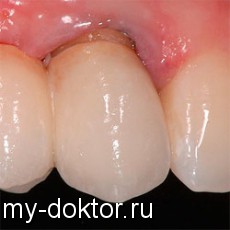 На вопросы пациентов отвечает врач стоматолог - MY-DOKTOR.RU