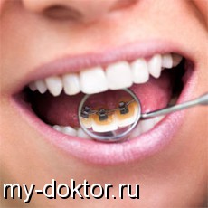 Ортопедическое лечение зубов лингвальными брекетами - MY-DOKTOR.RU