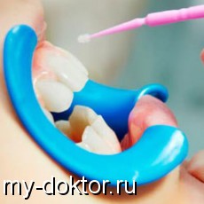 Стоматологические процедуры, которые позволят избежать лечения зубов - MY-DOKTOR.RU