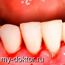 Вас консультируют лучшие специалисты! (стоматолог, терапевт, и педиатр) - MY-DOKTOR.RU