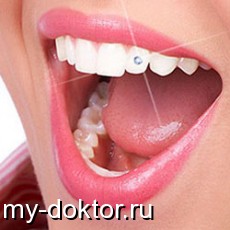 Виды украшений для зубов, особенности их установки и как за ними ухаживать - MY-DOKTOR.RU