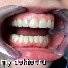 Врач стоматолог отвечает на Ваши вопросы - MY-DOKTOR.RU