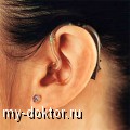 Для чего нужен слуховой аппарат - MY-DOKTOR.RU