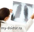 Как вылечить хроническую обструктивную болезнь легких - MY-DOKTOR.RU