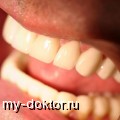 Киста зуба - симптомы и лечение - MY-DOKTOR.RU