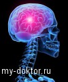 Мозговой инсульт - MY-DOKTOR.RU