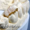Наращивание зубов - MY-DOKTOR.RU