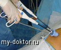 Особенности гинекологической лапароскопии - MY-DOKTOR.RU
