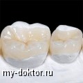 Протезирование зубов с применением вкладок - MY-DOKTOR.RU