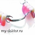Протезирование зубов съемными протезами - MY-DOKTOR.RU