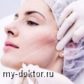 Процедура тредлифтинга - армирование кожных покровов мезонитями - MY-DOKTOR.RU