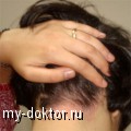 Псориаз волосистой части головы: лечение народными средствами - MY-DOKTOR.RU