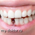 Спасение зубов – в руках профессионалов - MY-DOKTOR.RU