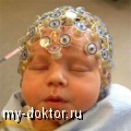 Церебральная ишемия у новорожденных - MY-DOKTOR.RU