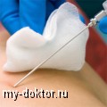 Трансбронхиальная биопсия легких - MY-DOKTOR.RU