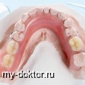 Виды и методы протезирования зубов - MY-DOKTOR.RU